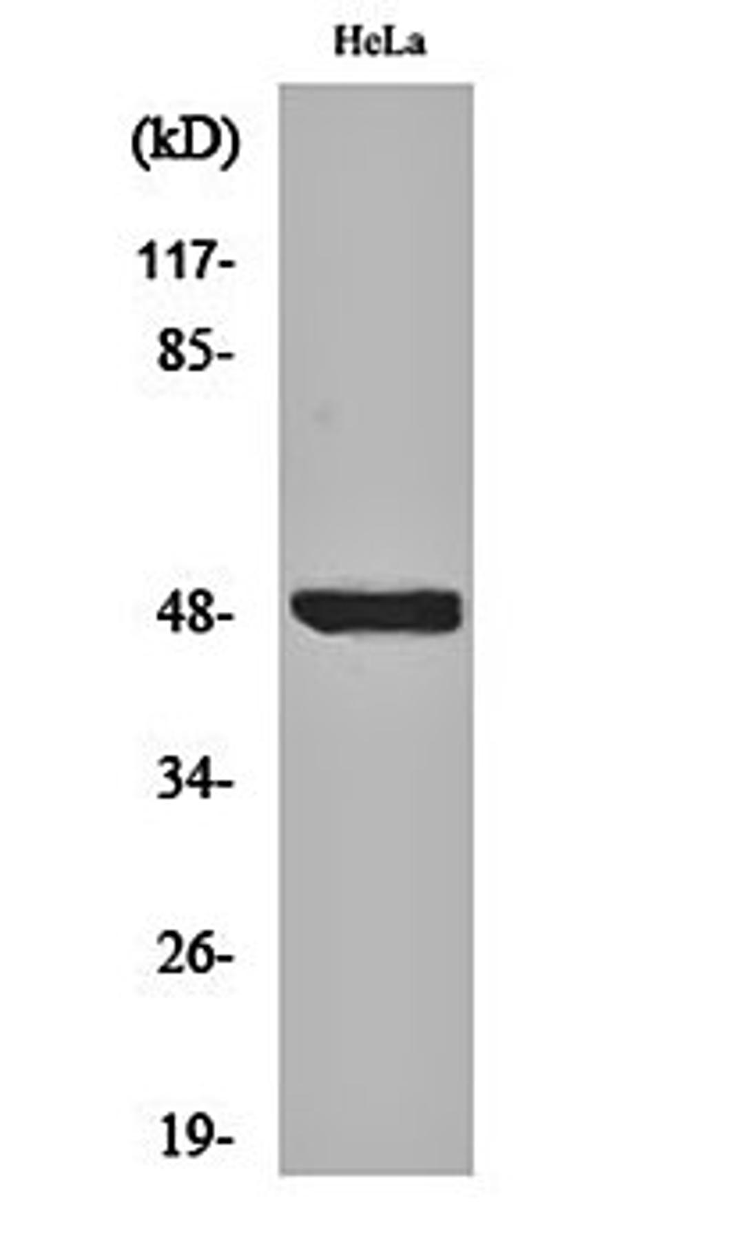 Western blot analysis of Hela cell lysates using I kappa B- beta (phospho-S23) antibody