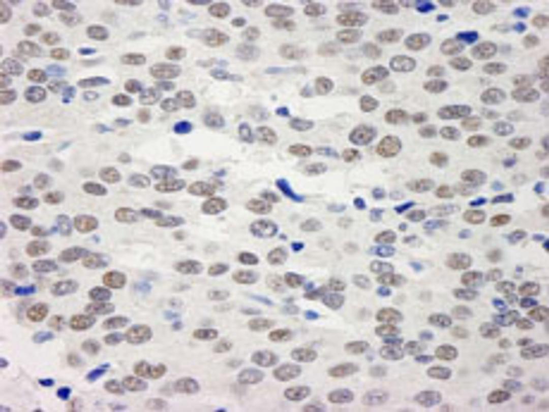 Detection of human BHC110/LSD1 by immunohistochemistry.