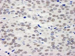 Detection of human BHC110/LSD1 by immunohistochemistry.