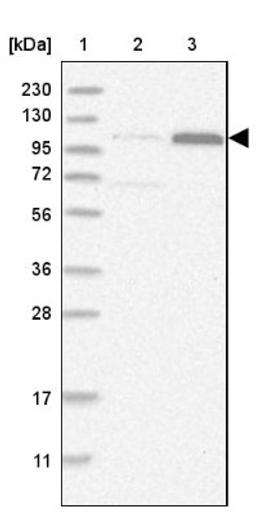 Western Blot: ZCCHC11/TUT4 Antibody [NBP1-83027] - Lane 1: Marker [kDa] 230, 130, 95, 72, 56, 36, 28, 17, 11<br/>Lane 2: Human cell line RT-4<br/>Lane 3: Human cell line U-251MG sp