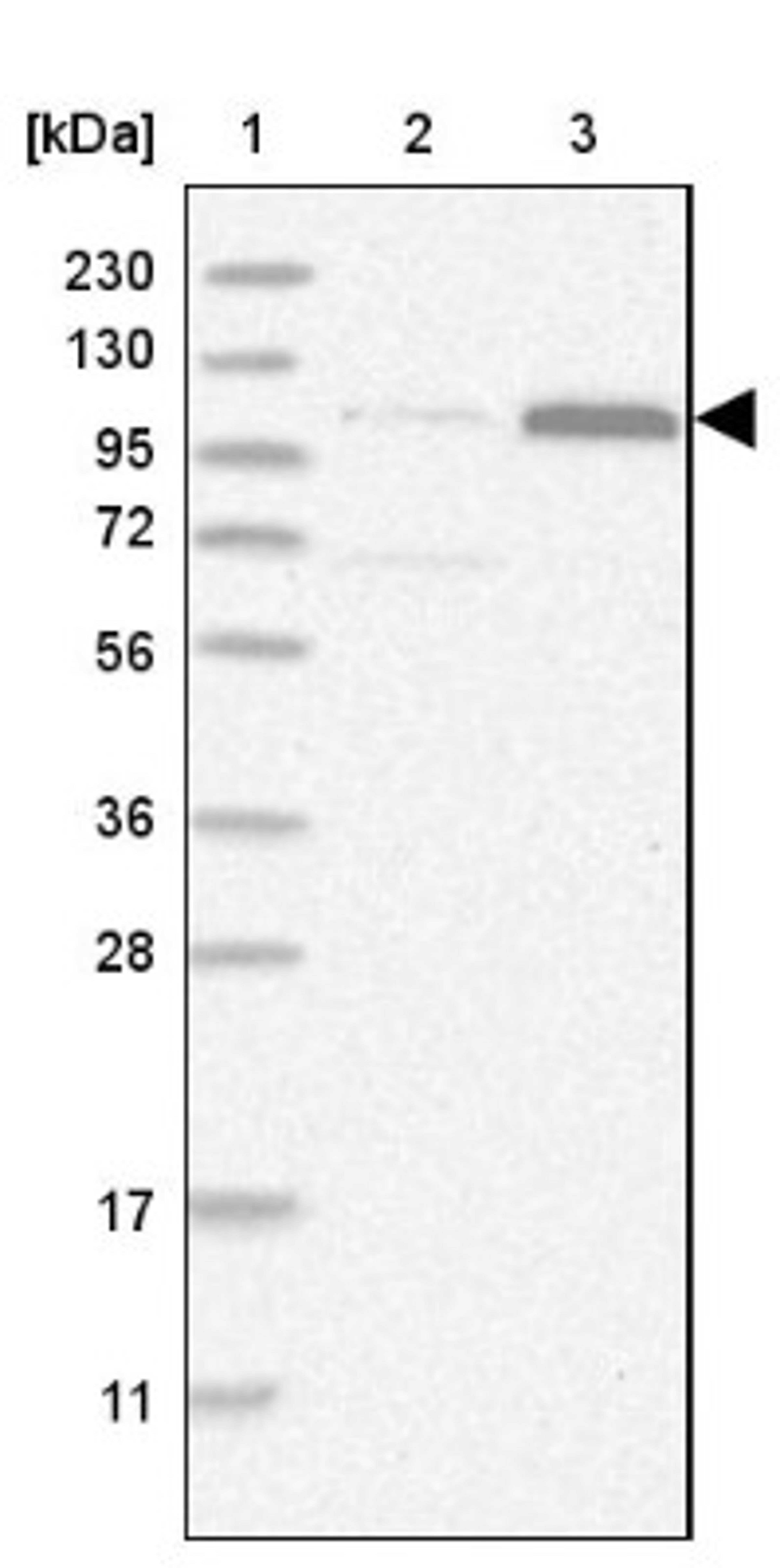 Western Blot: ZCCHC11/TUT4 Antibody [NBP1-83027] - Lane 1: Marker [kDa] 230, 130, 95, 72, 56, 36, 28, 17, 11<br/>Lane 2: Human cell line RT-4<br/>Lane 3: Human cell line U-251MG sp