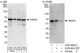 Detection of human TRAF2 by western blot and immunoprecipitation.