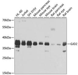 Western blot - GJD2 antibody (A2883)