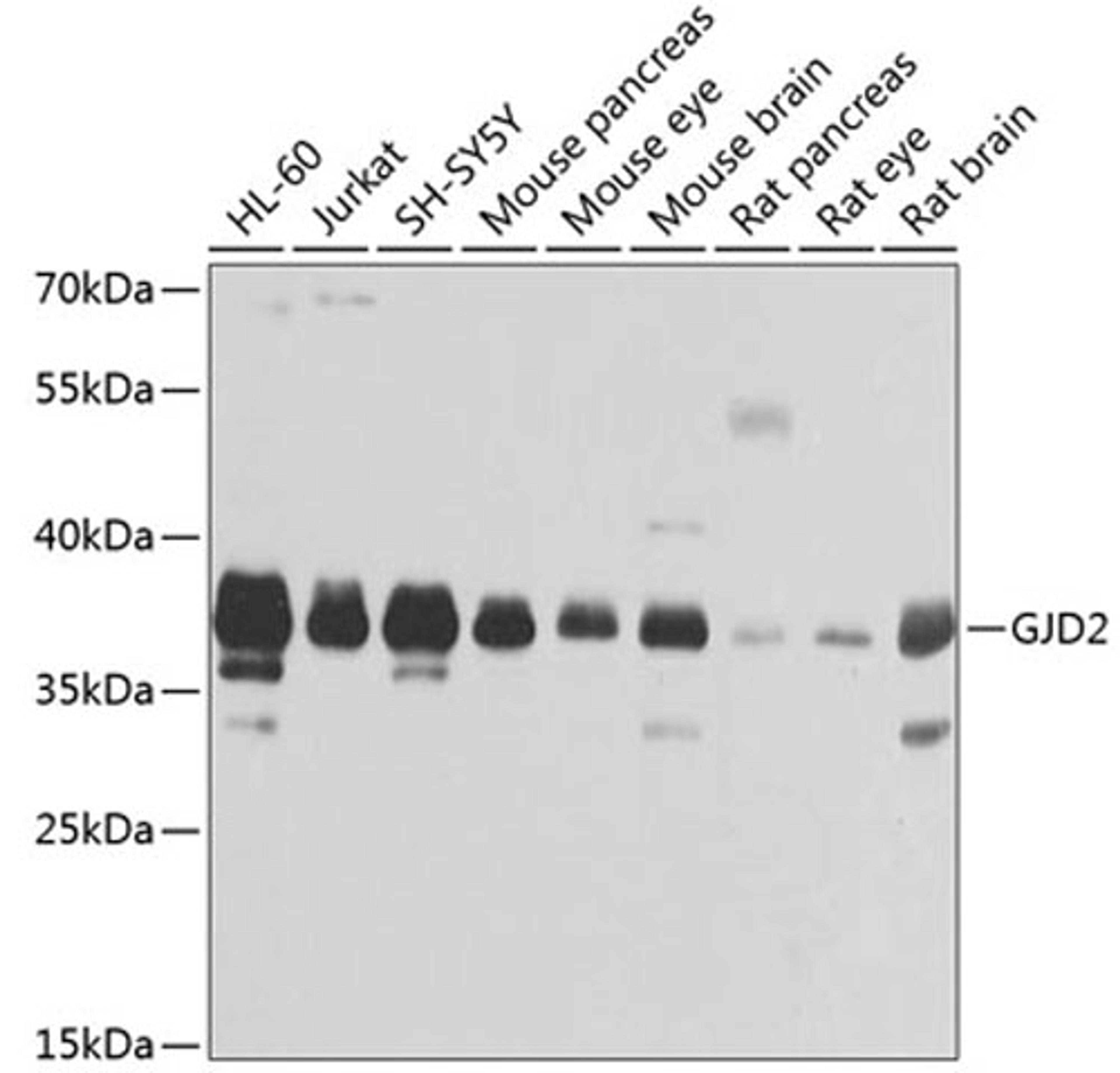 Western blot - GJD2 antibody (A2883)