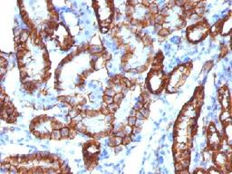 Immunohistochemical staining of mouse Kidney tissue using CDH16 antibody