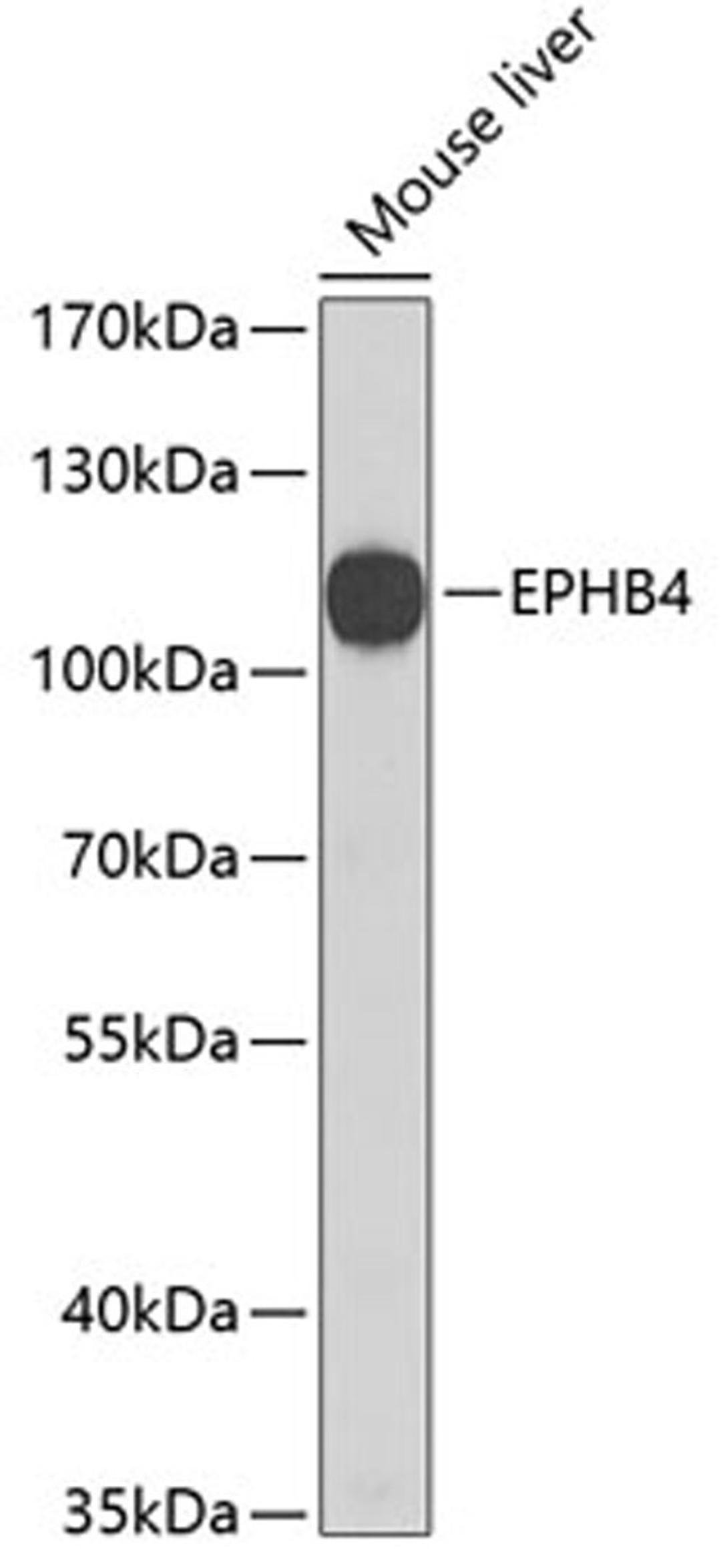 Western blot - EPHB4 antibody (A3293)