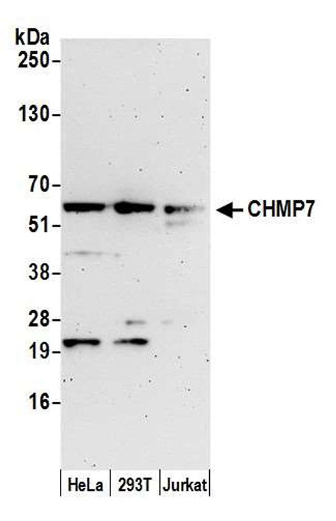 Detection of human CHMP7 by WB.