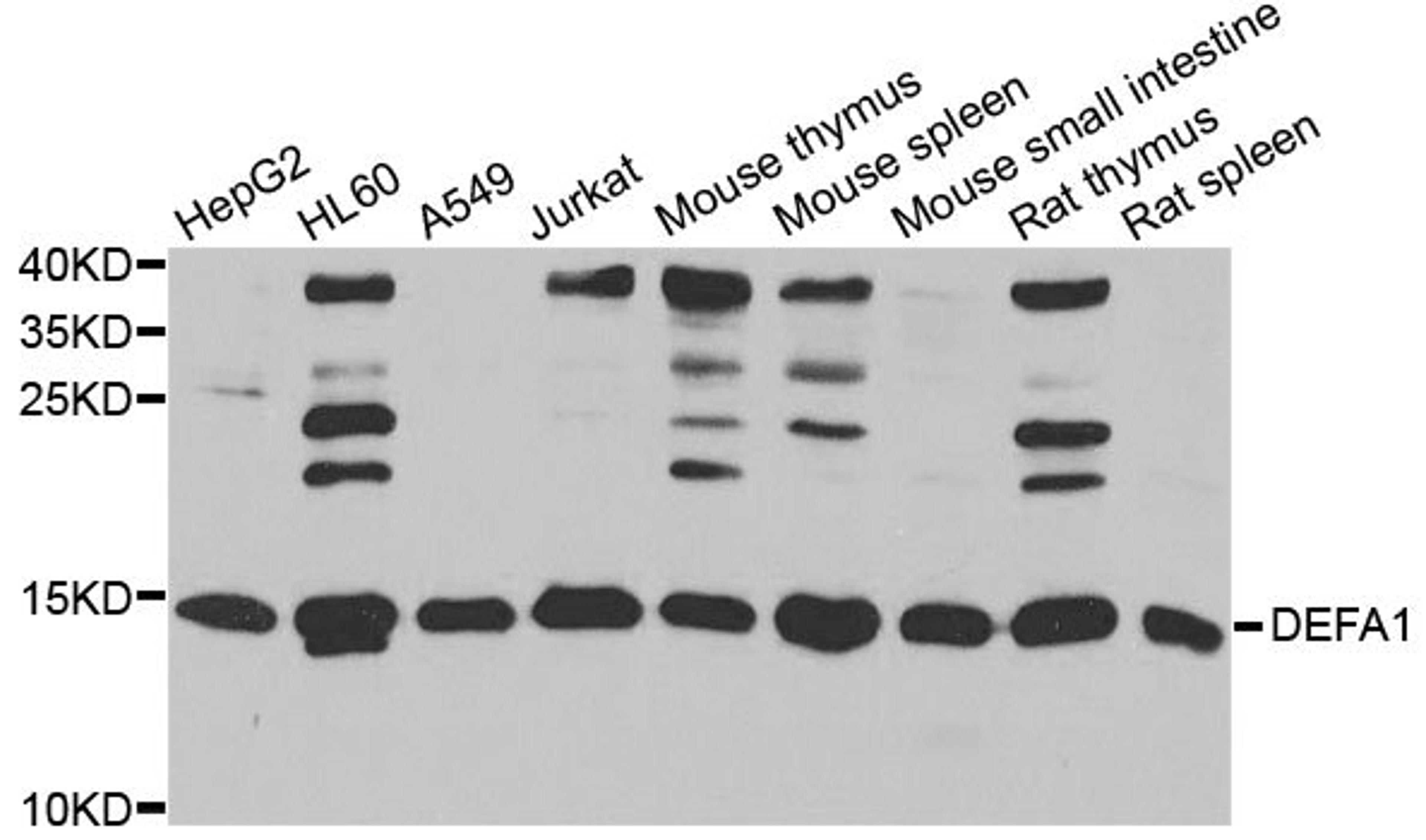 Western blot - DEFA1 antibody (A6897)