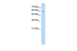 Antibody used in WB on Human Jurkat 0.2-1 ug/ml.