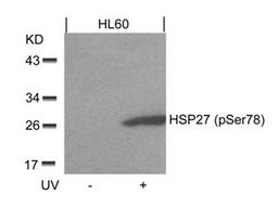 Western blot analysis of lysed extracts from HL60 cells untreated or treated with UV using HSP27 (Phospho-Ser78).