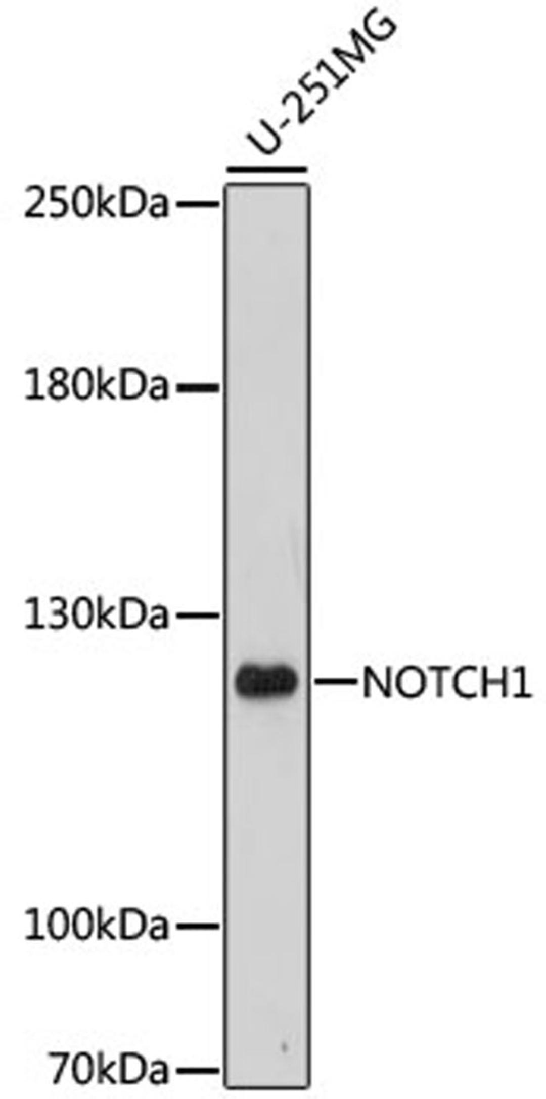 Western blot - NOTCH1 antibody (A16673)