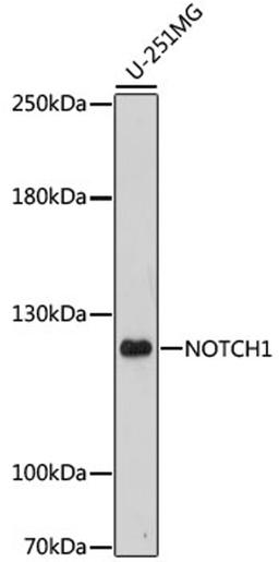 Western blot - NOTCH1 antibody (A16673)