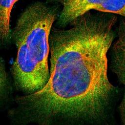 Immunocytochemistry/Immunofluorescence: FLNC Antibody [NBP1-89300] - Staining of human cell line U-2 OS shows positivity in plasma membrane & cytoplasm.