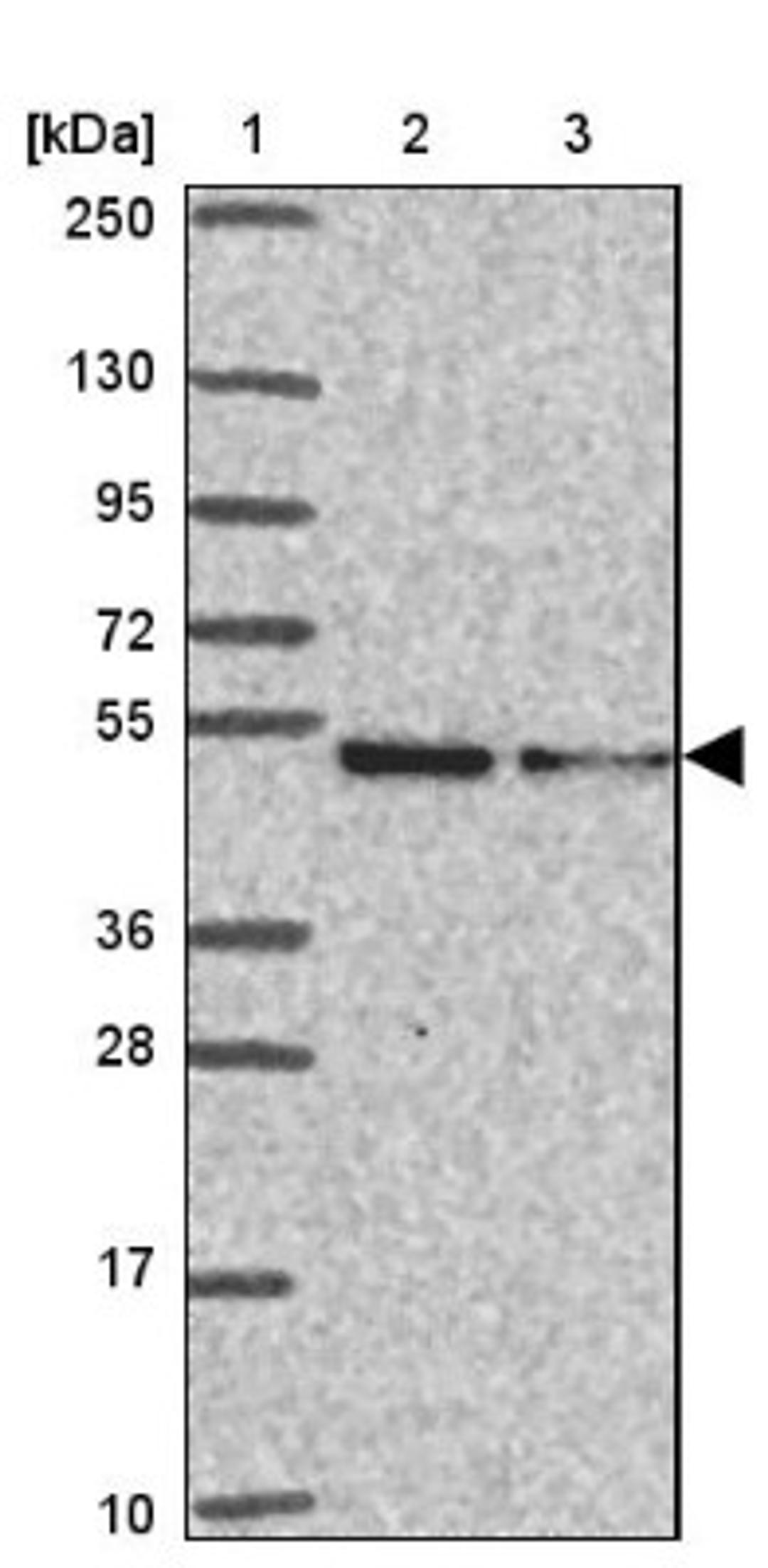 Western Blot: HELIOS Antibody [NBP2-34122] - Lane 1: Marker [kDa] 250, 130, 95, 72, 55, 36, 28, 17, 10<br/>Lane 2: Human cell line RT-4<br/>Lane 3: Human cell line U-251MG sp