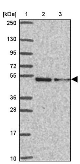 Western Blot: HELIOS Antibody [NBP2-34122] - Lane 1: Marker [kDa] 250, 130, 95, 72, 55, 36, 28, 17, 10<br/>Lane 2: Human cell line RT-4<br/>Lane 3: Human cell line U-251MG sp