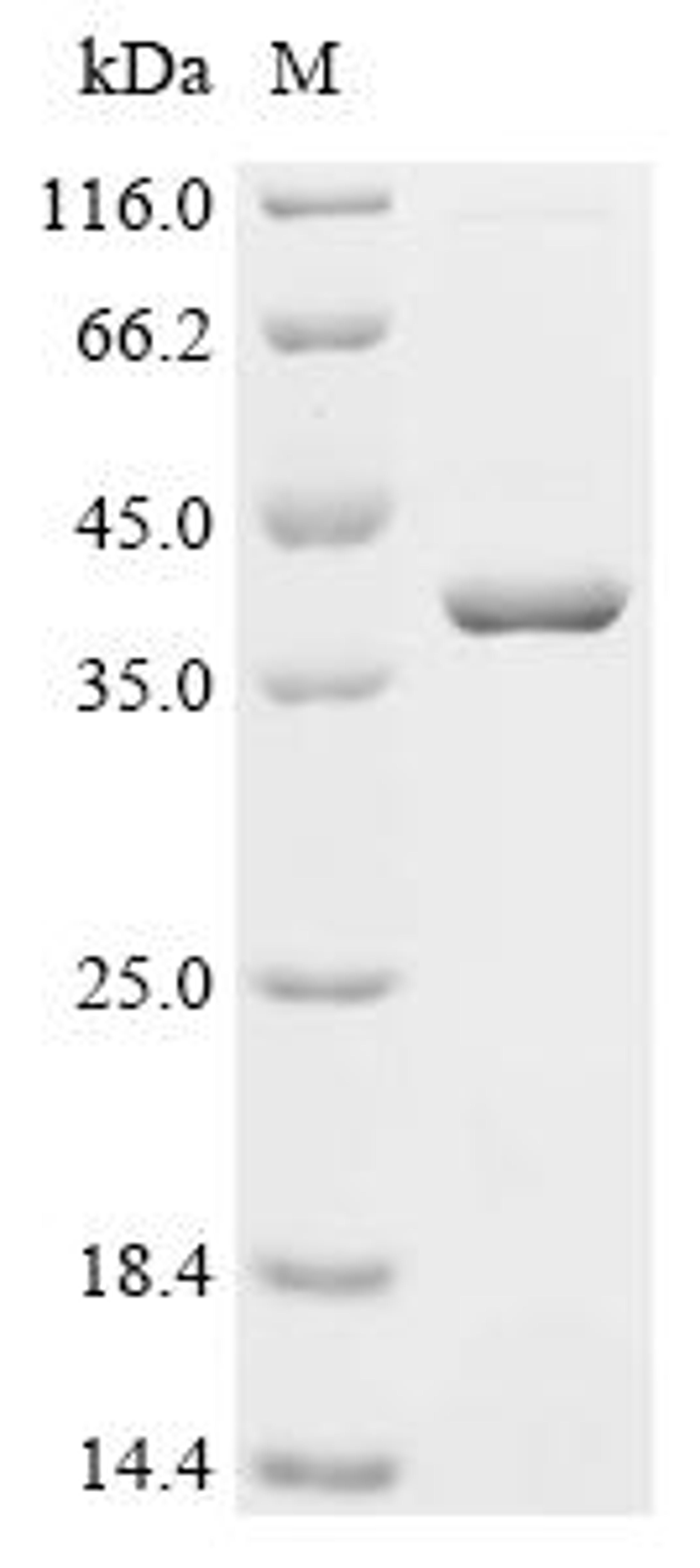 (Tris-Glycine gel) Discontinuous SDS-PAGE (reduced) with 5% enrichment gel and 15% separation gel.