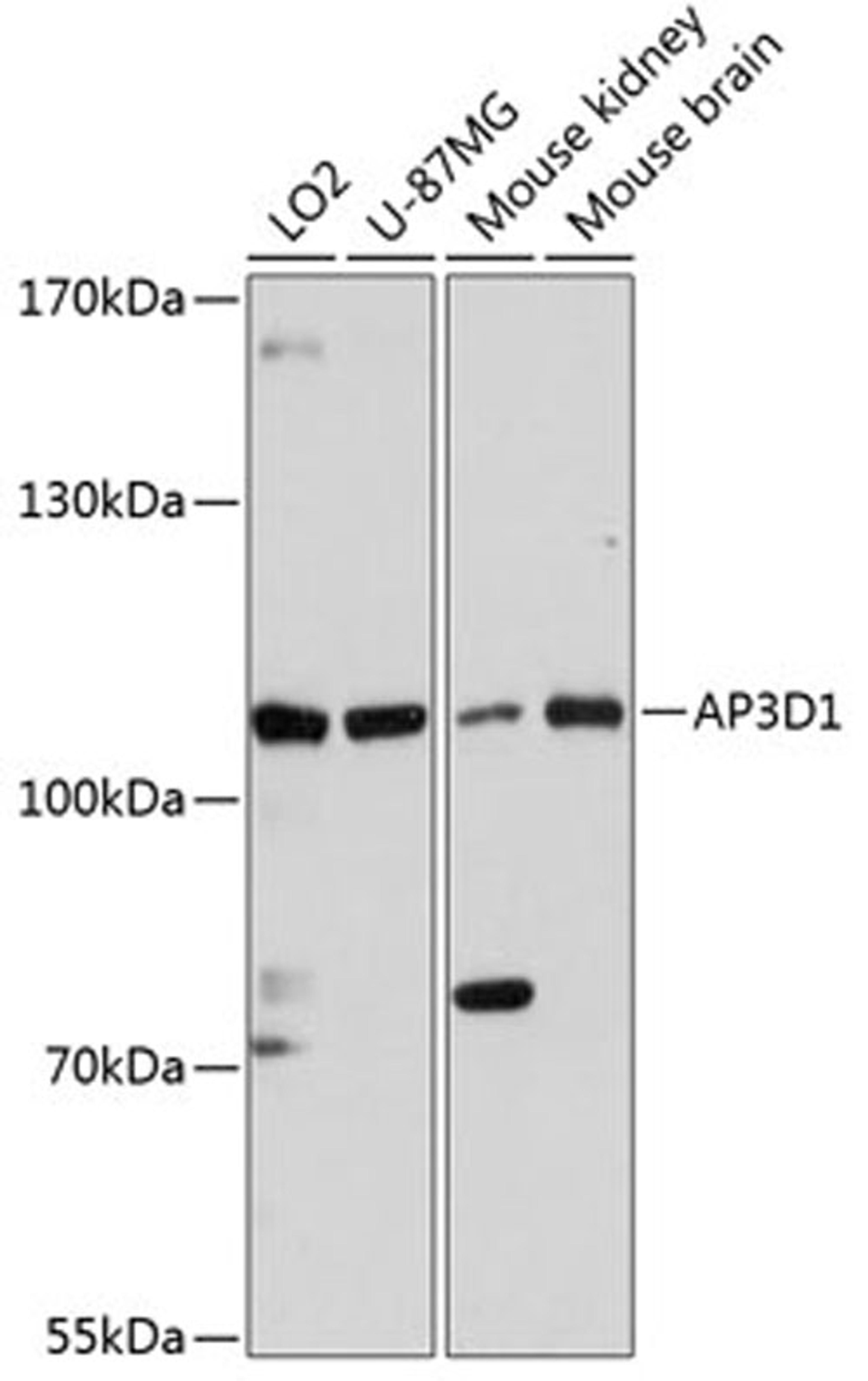 Western blot - AP3D1 antibody (A13058)