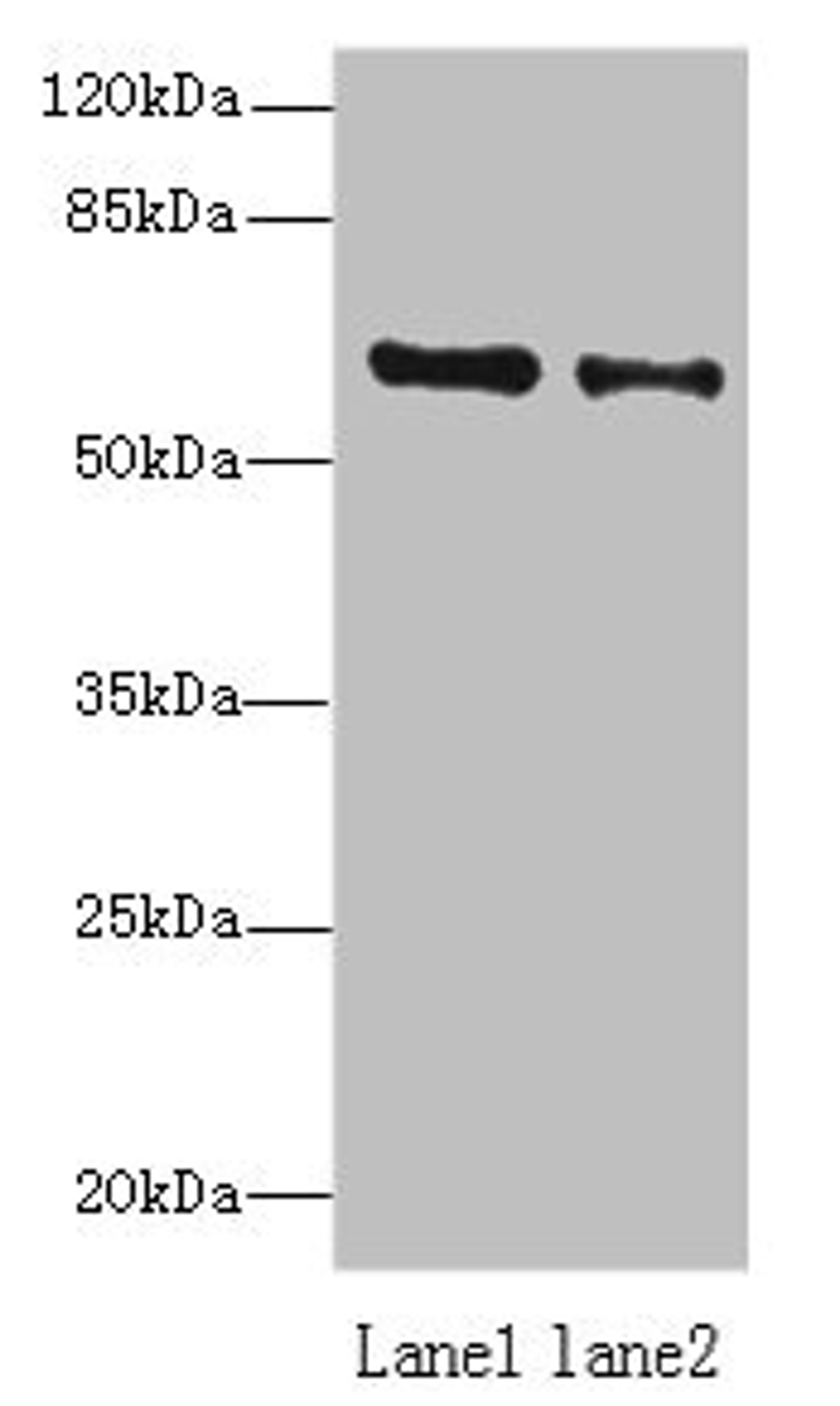 Western blot. All lanes: ZNF626 antibody at 10µg/ml. Lane 1: HepG2 whole cell lysate. Lane 2: Raji whole cell lysate. Secondary. Goat polyclonal to rabbit IgG at 1/10000 dilution. Predicted band size: 61, 53, 11 kDa. Observed band size: 61 kDa