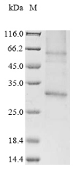 (Tris-Glycine gel) Discontinuous SDS-PAGE (reduced) with 5% enrichment gel and 15% separation gel.