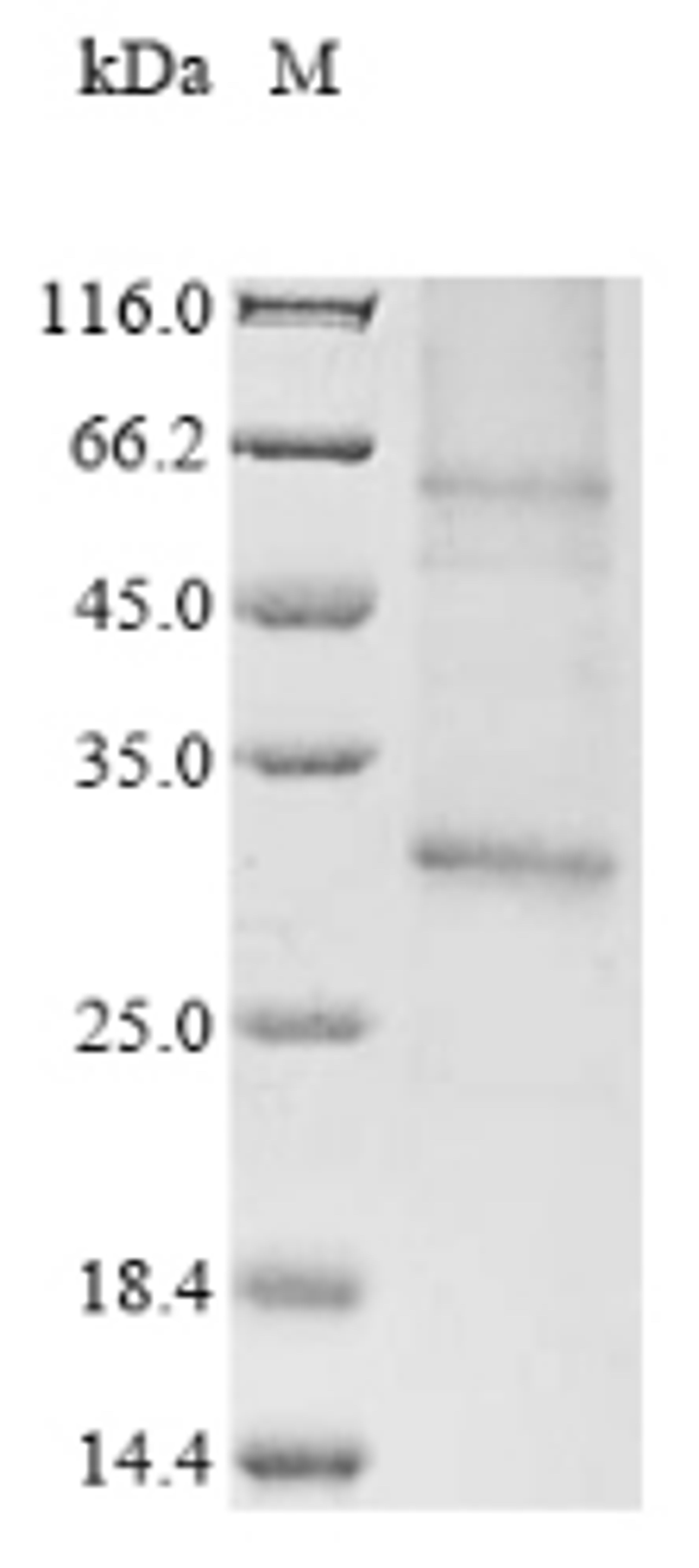 (Tris-Glycine gel) Discontinuous SDS-PAGE (reduced) with 5% enrichment gel and 15% separation gel.