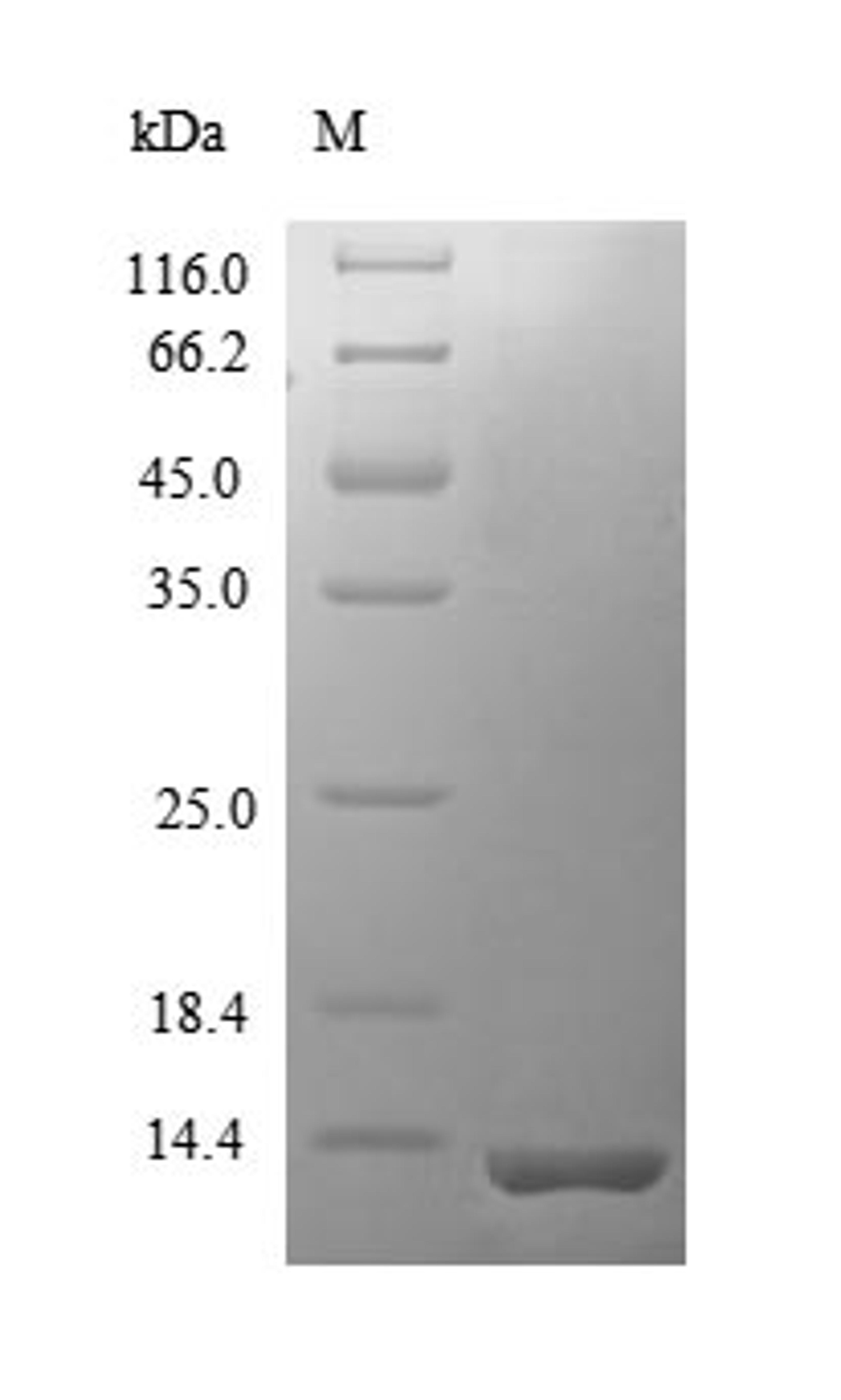 (Tris-Glycine gel) Discontinuous SDS-PAGE (reduced) with 5% enrichment gel and 15% separation gel.