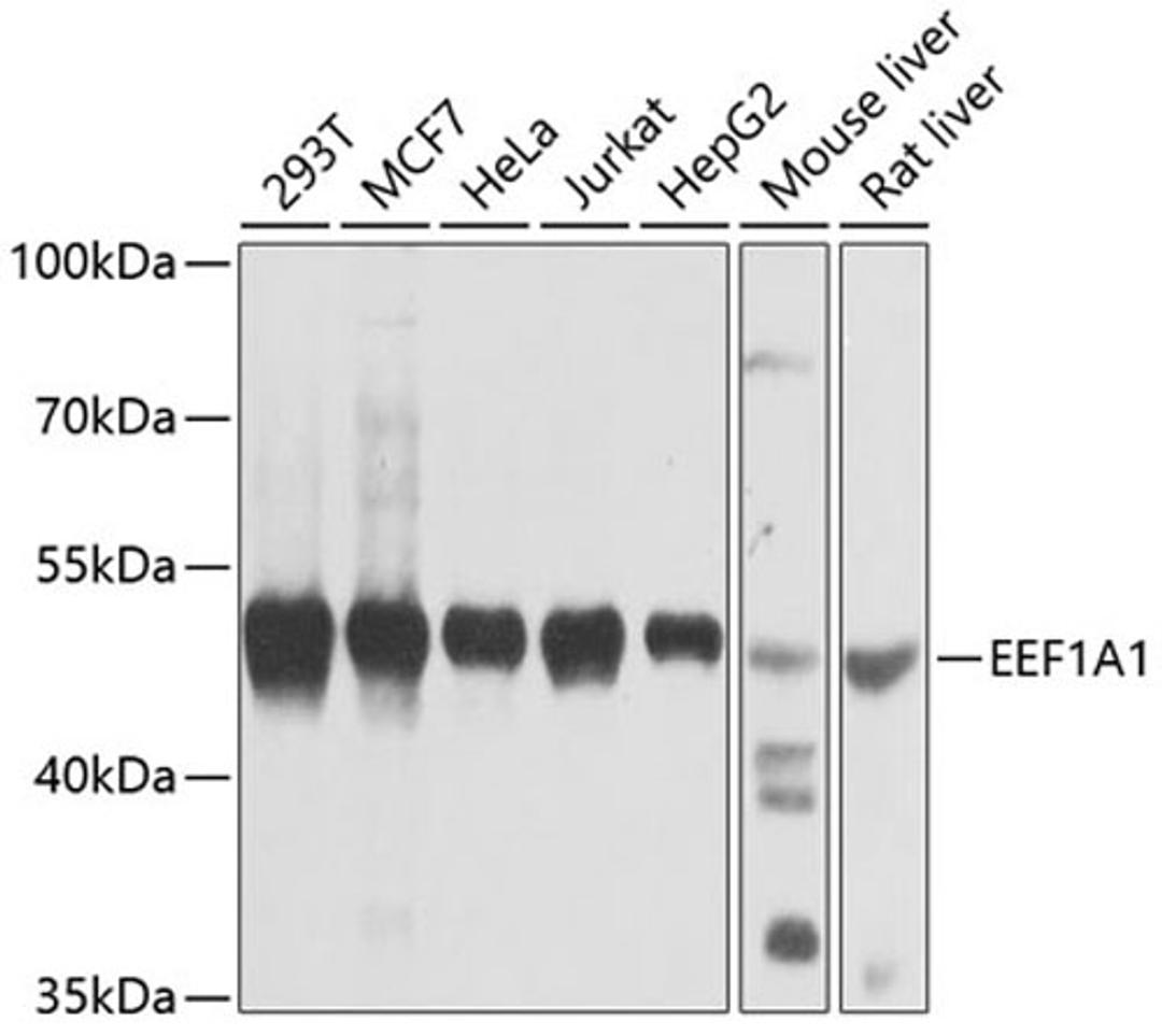 Western blot - EEF1A1 antibody (A0974)