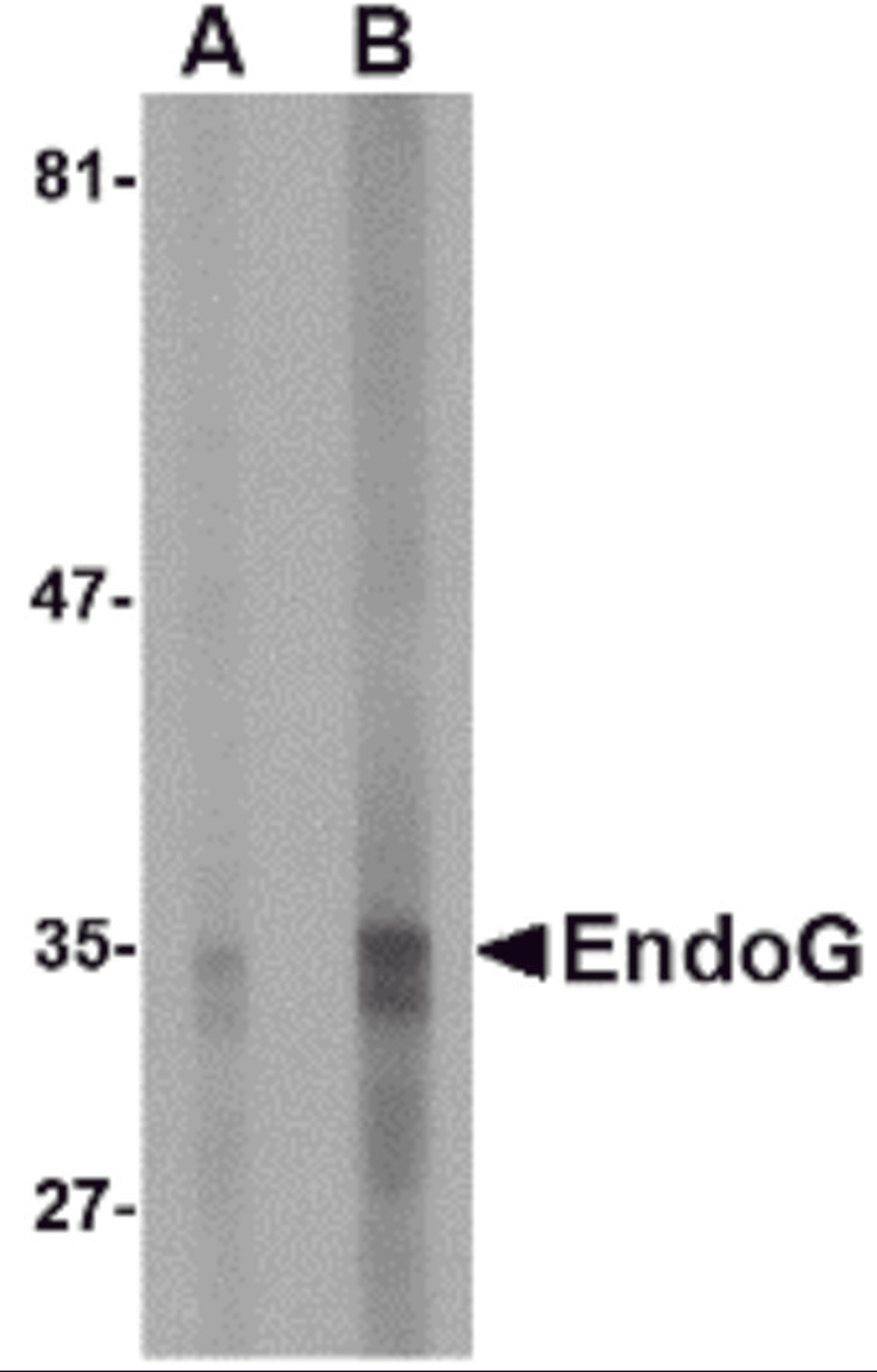 Western blot analysis of EndoG expression in HepG2 cell lysate with EndoG antibody at (A) 5 and (B) 10 &#956;g/mL.