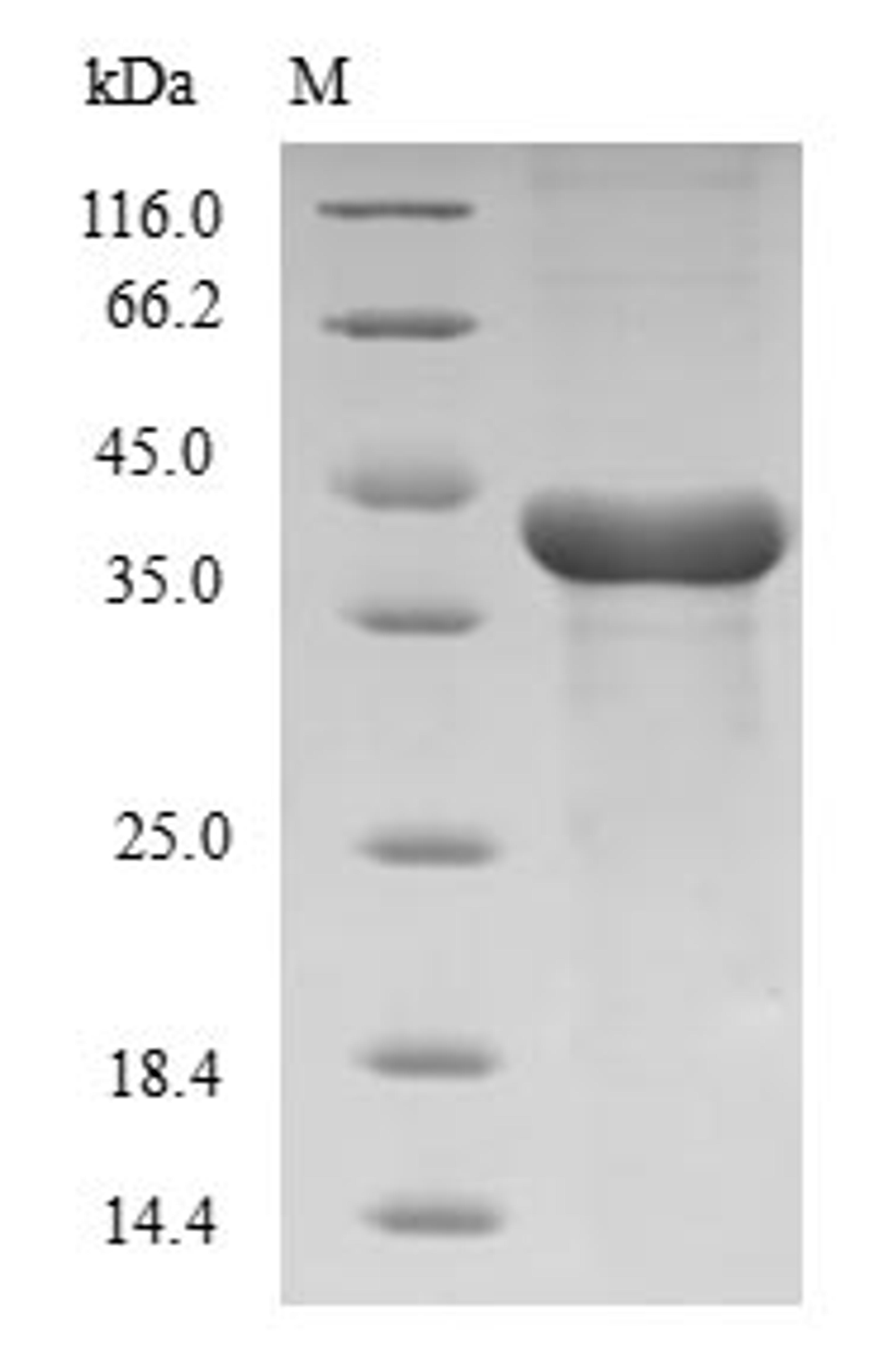 (Tris-Glycine gel) Discontinuous SDS-PAGE (reduced) with 5% enrichment gel and 15% separation gel.
