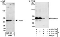 Detection of human Coronin 1 by western blot and immunoprecipitation.