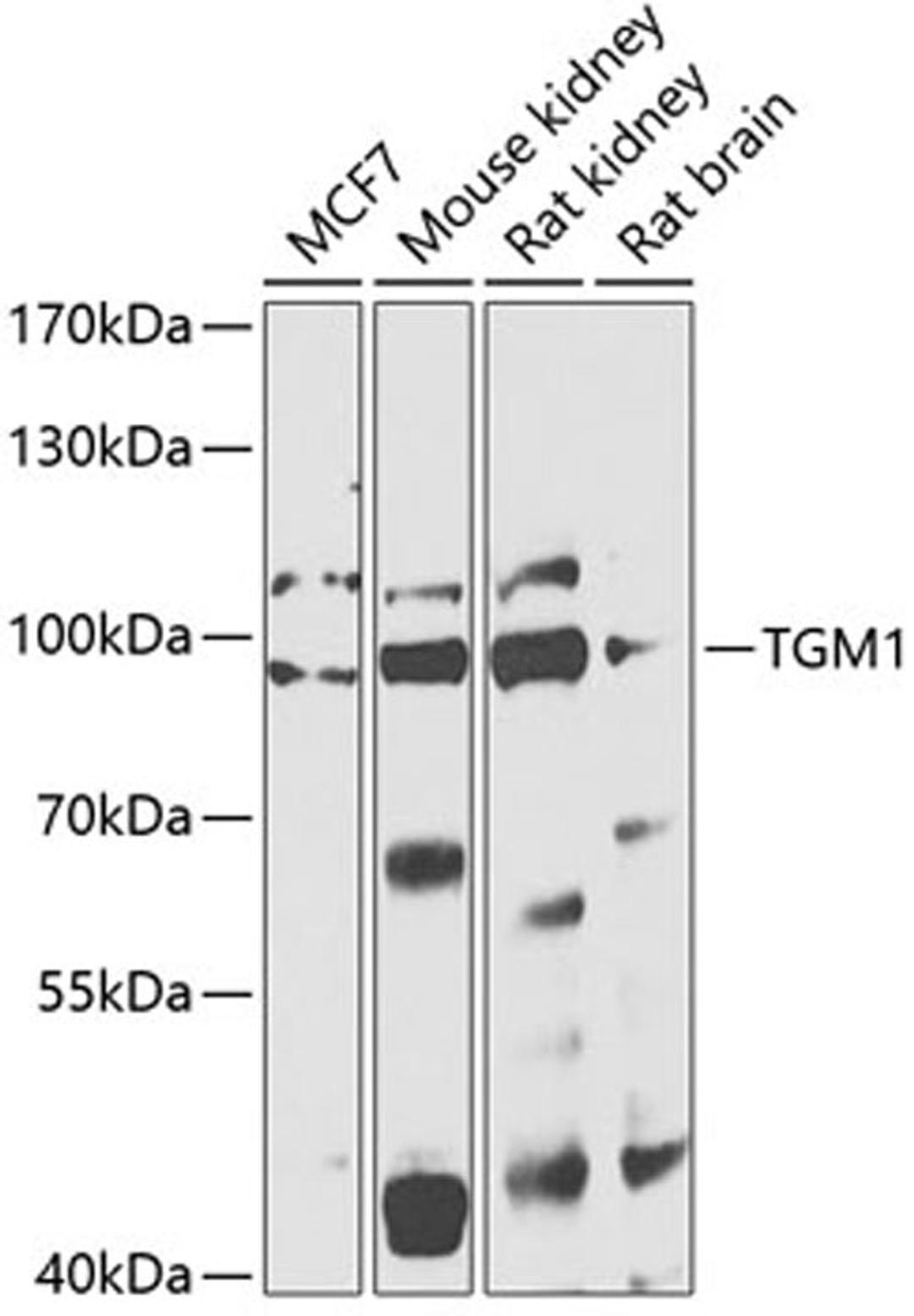 Western blot - TGM1 antibody (A13359)