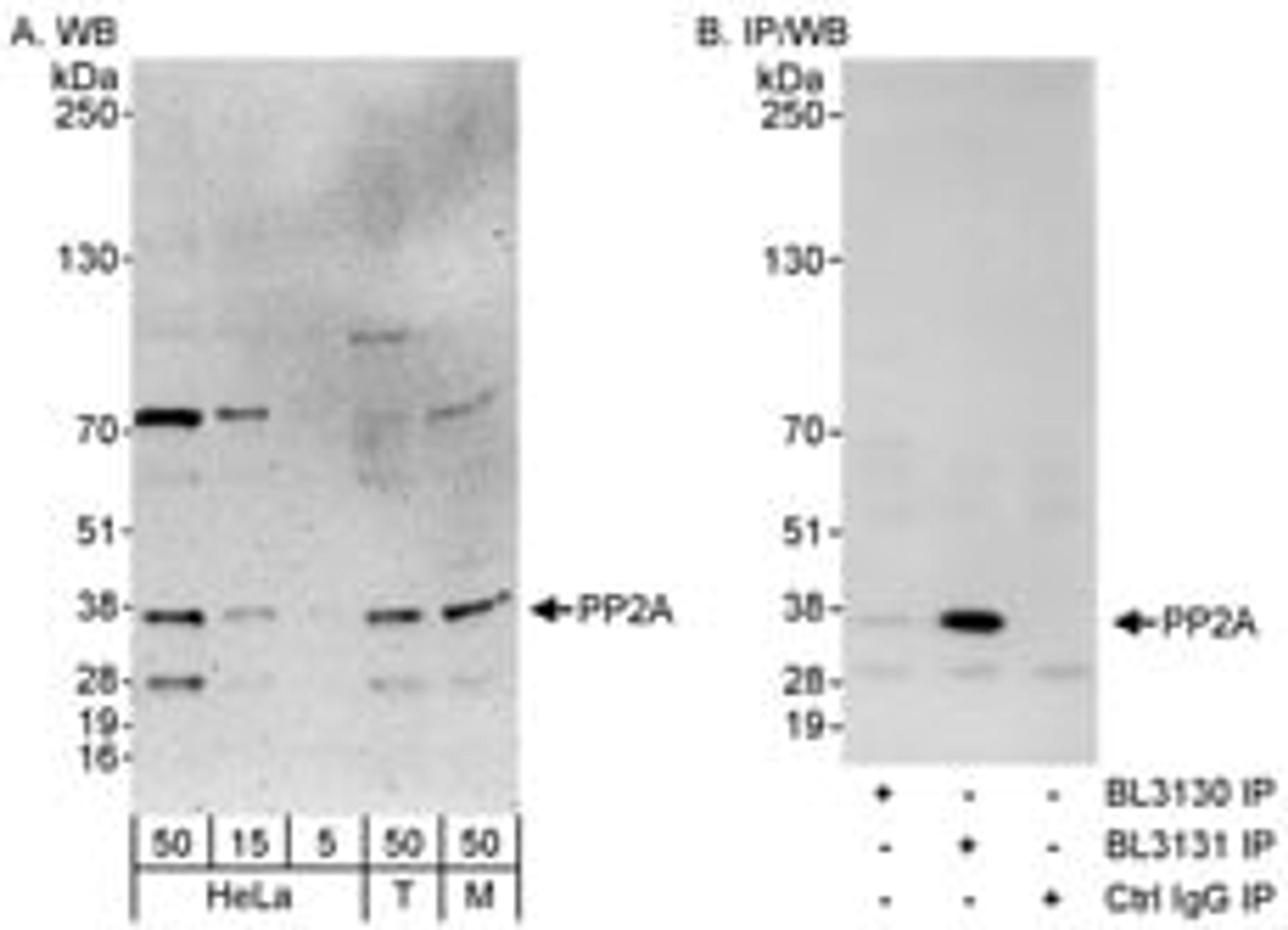 Detection of human and mouse PP2A by western blot (h&m) and immunoprecipitation (h).