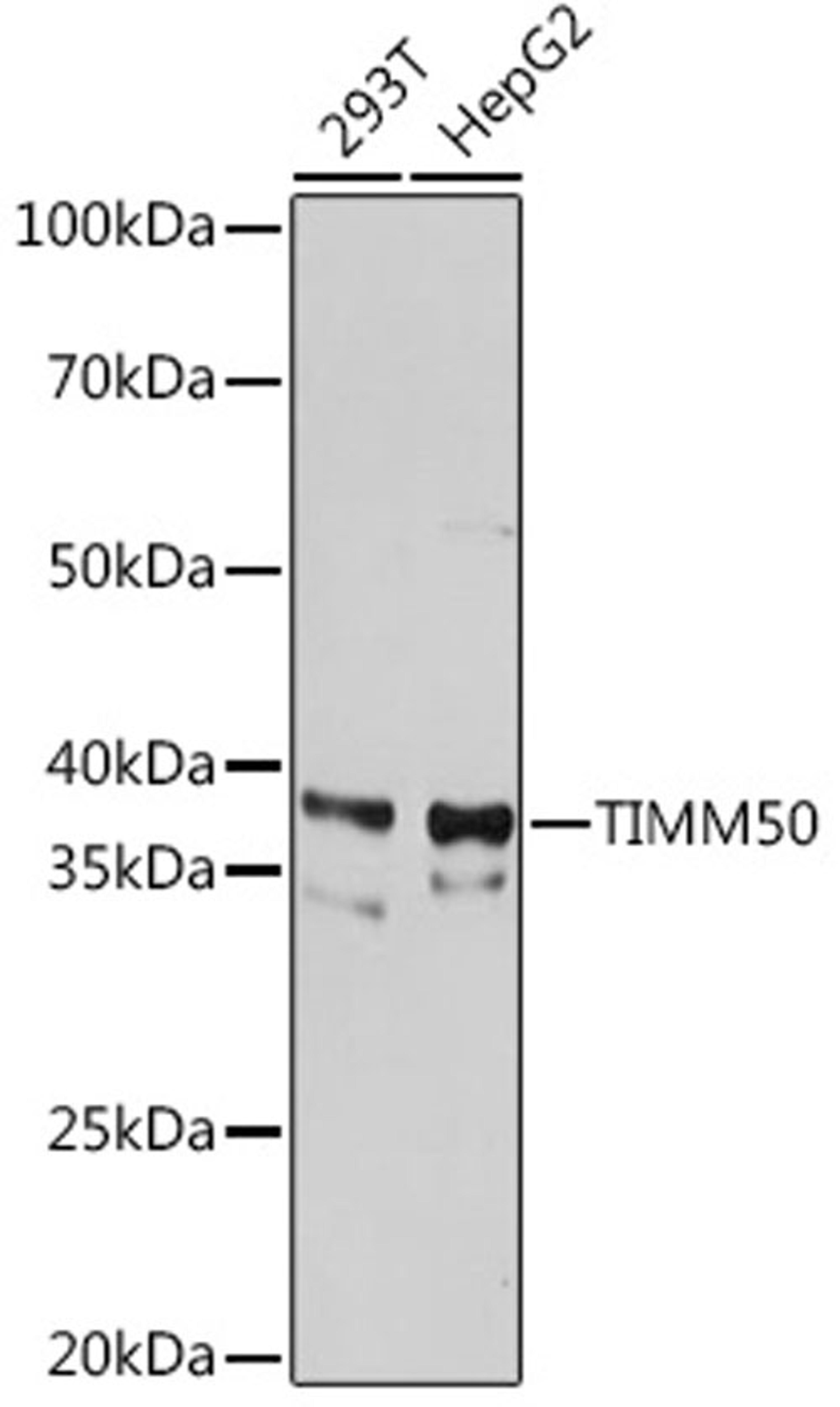 Western blot - TIMM50 Rabbit mAb (A1536)