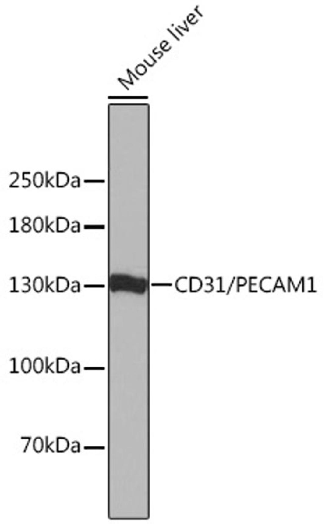 Western blot - CD31/PECAM1 antibody (A0378)