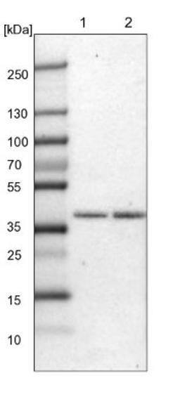 Western Blot: ZDHHC20 Antibody [NBP1-82046] - Lane 1: Mouse liver tissue lysate<br/>Lane 2: Rat liver tissue lysate