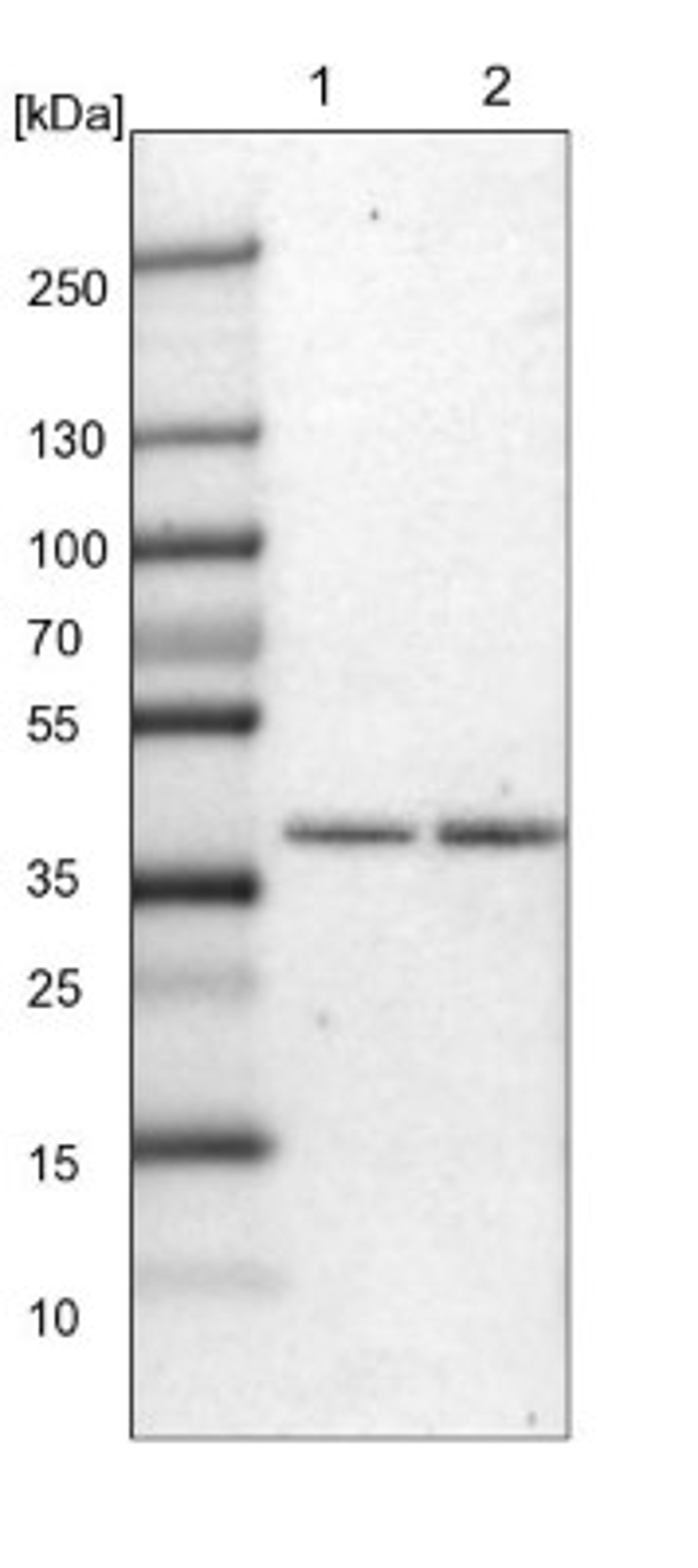 Western Blot: ZDHHC20 Antibody [NBP1-82046] - Lane 1: Mouse liver tissue lysate<br/>Lane 2: Rat liver tissue lysate