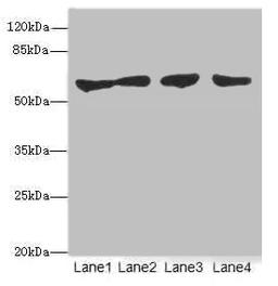 Western blot. All lanes: CLK1antibody at 3.07ug/ml. Lane 1: HepG2 whole cell lysate. Lane 2: Jurkat whole cell lysate. Lane 3: U251 whole cell lysate. Lane 4: A549 whole cell lysate. Secondary. Goat polyclonal to rabbit IgG at 1/10000 dilution. Predicted band size: 58, 17, 62 kDa. Observed band size: 58 kDa.