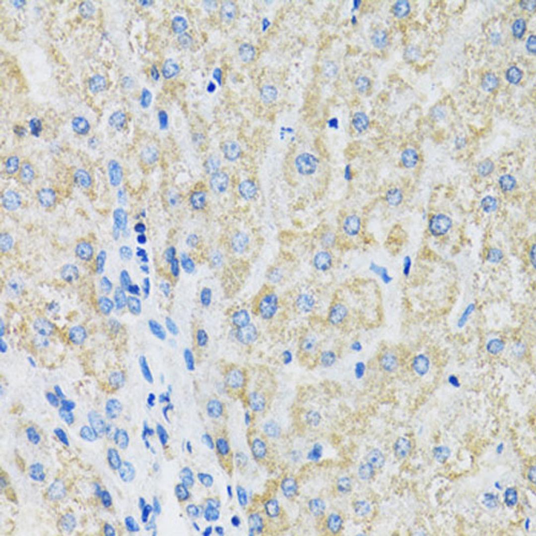 Immunohistochemistry  - SLC19A1 antibody (A14644)