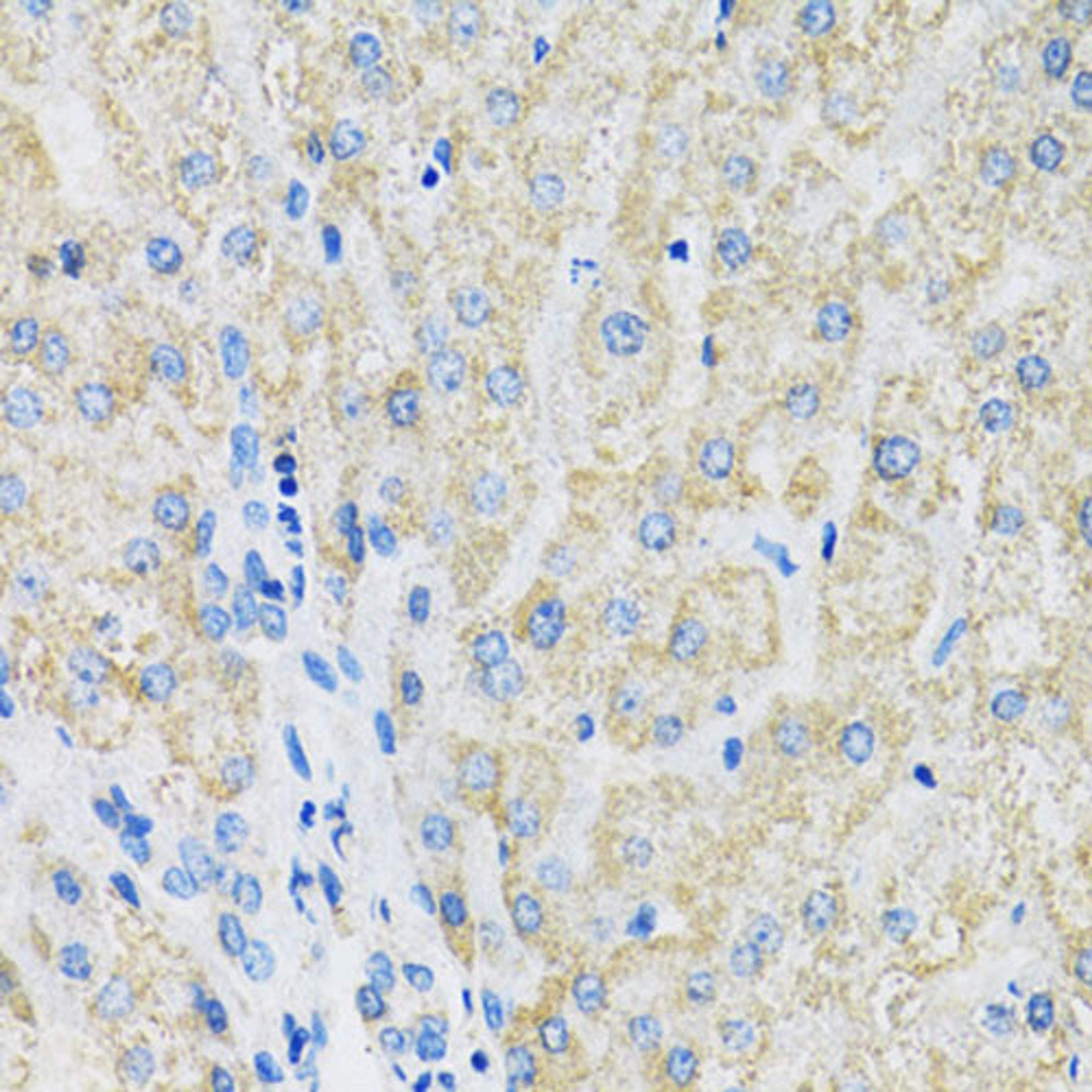 Immunohistochemistry  - SLC19A1 antibody (A14644)