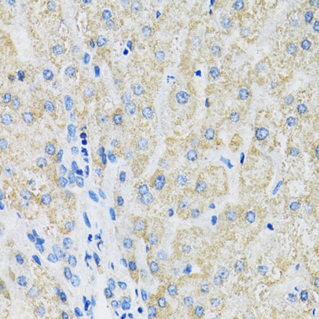 Immunohistochemistry - SLC19A1 antibody (A14644)