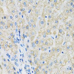 Immunohistochemistry - SLC19A1 antibody (A14644)