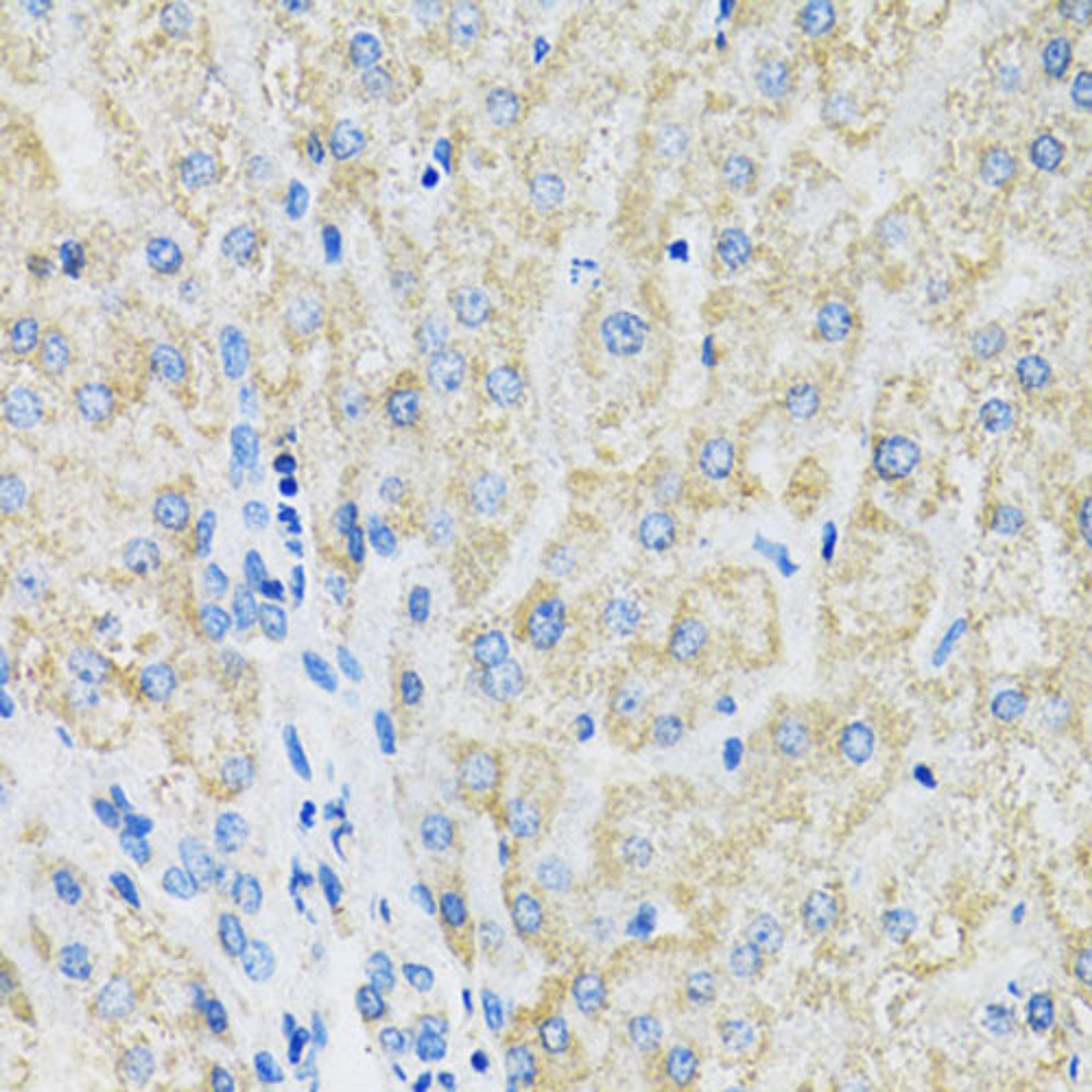 Immunohistochemistry - SLC19A1 antibody (A14644)