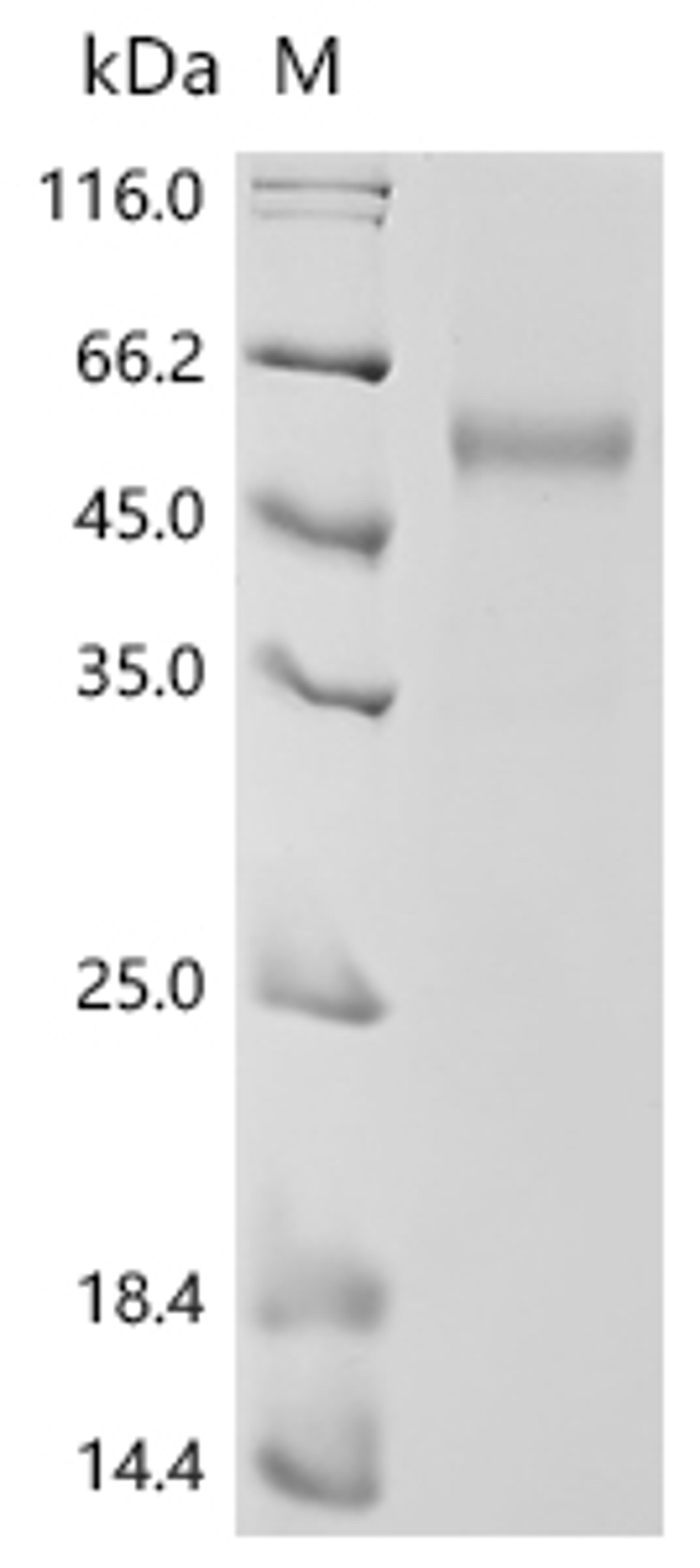 (Tris-Glycine gel) Discontinuous SDS-PAGE (reduced) with 5% enrichment gel and 15% separation gel.