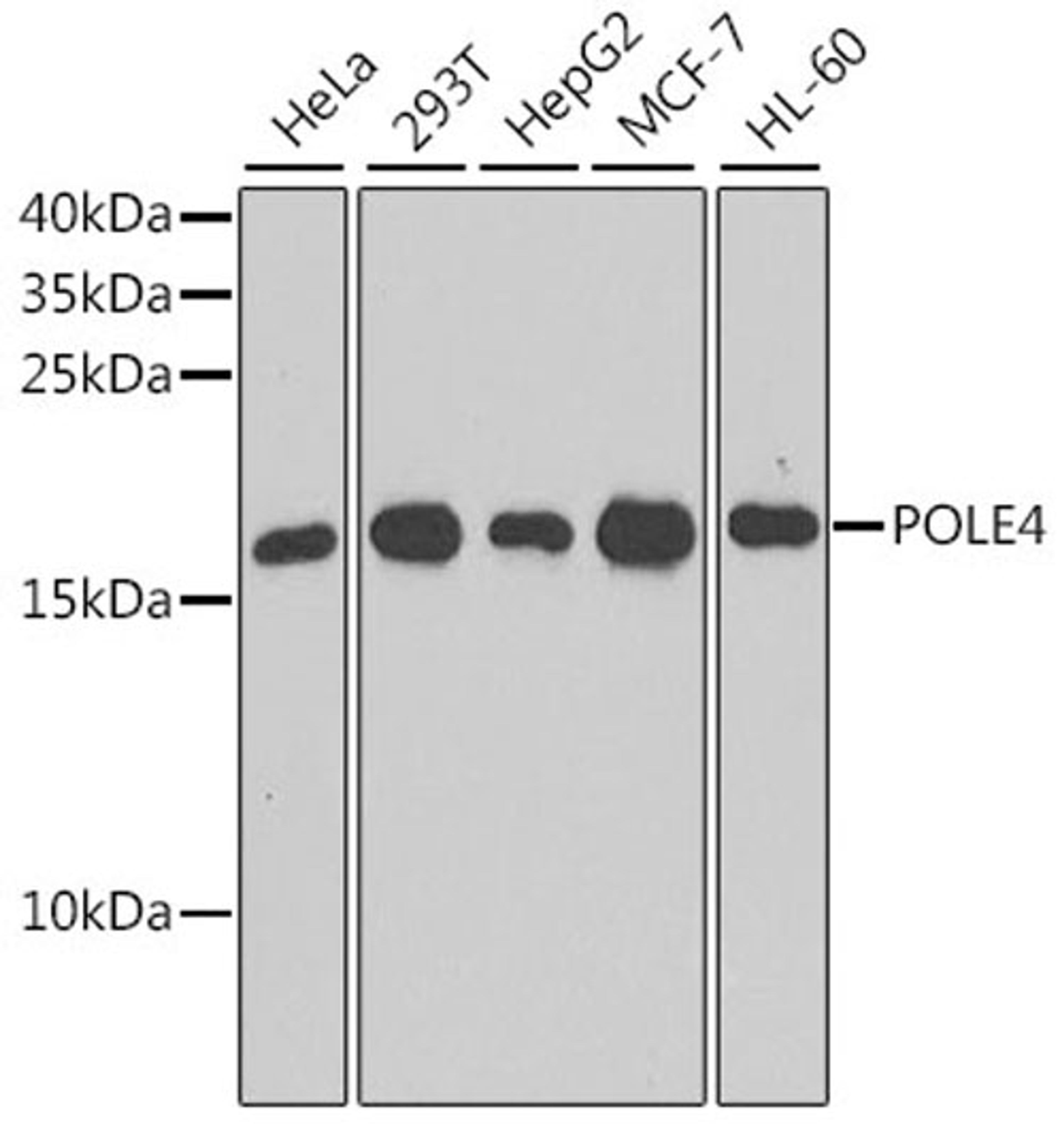 Western blot - POLE4 antibody (A9882)