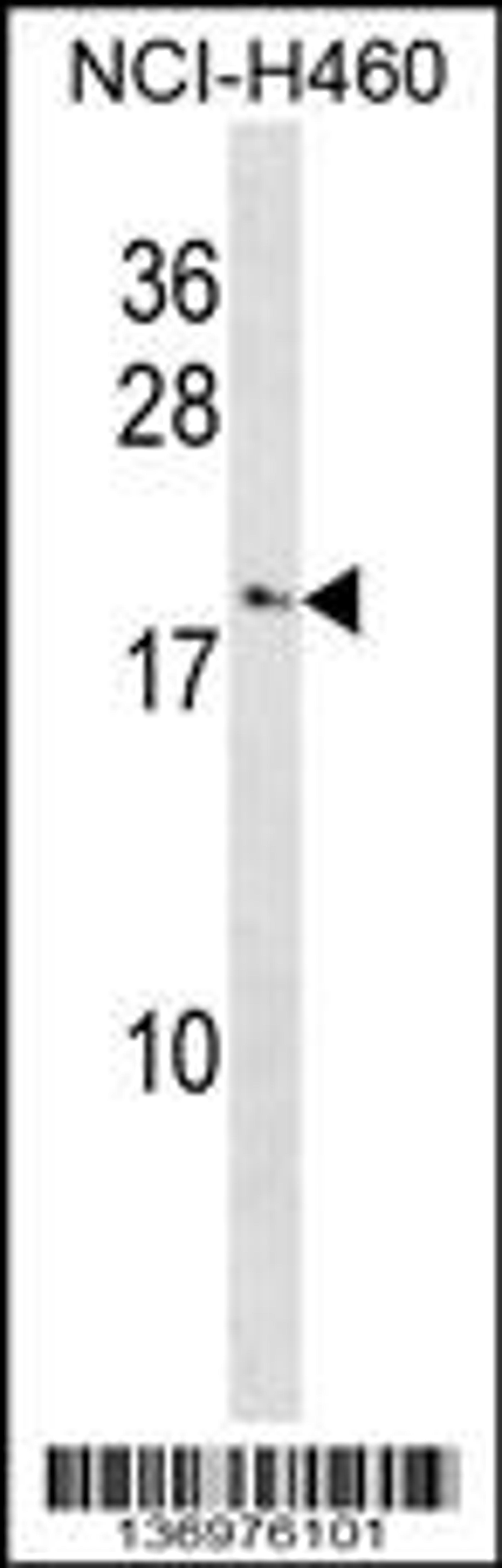 Western blot analysis in NCI-H460 cell line lysates (35ug/lane).