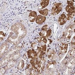 Immunohistochemistry: NAALADase-2/NAALAD2 Antibody [NBP2-31840] - Staining of human stomach, lower shows strong cytoplasmic positivity in glandular cells.