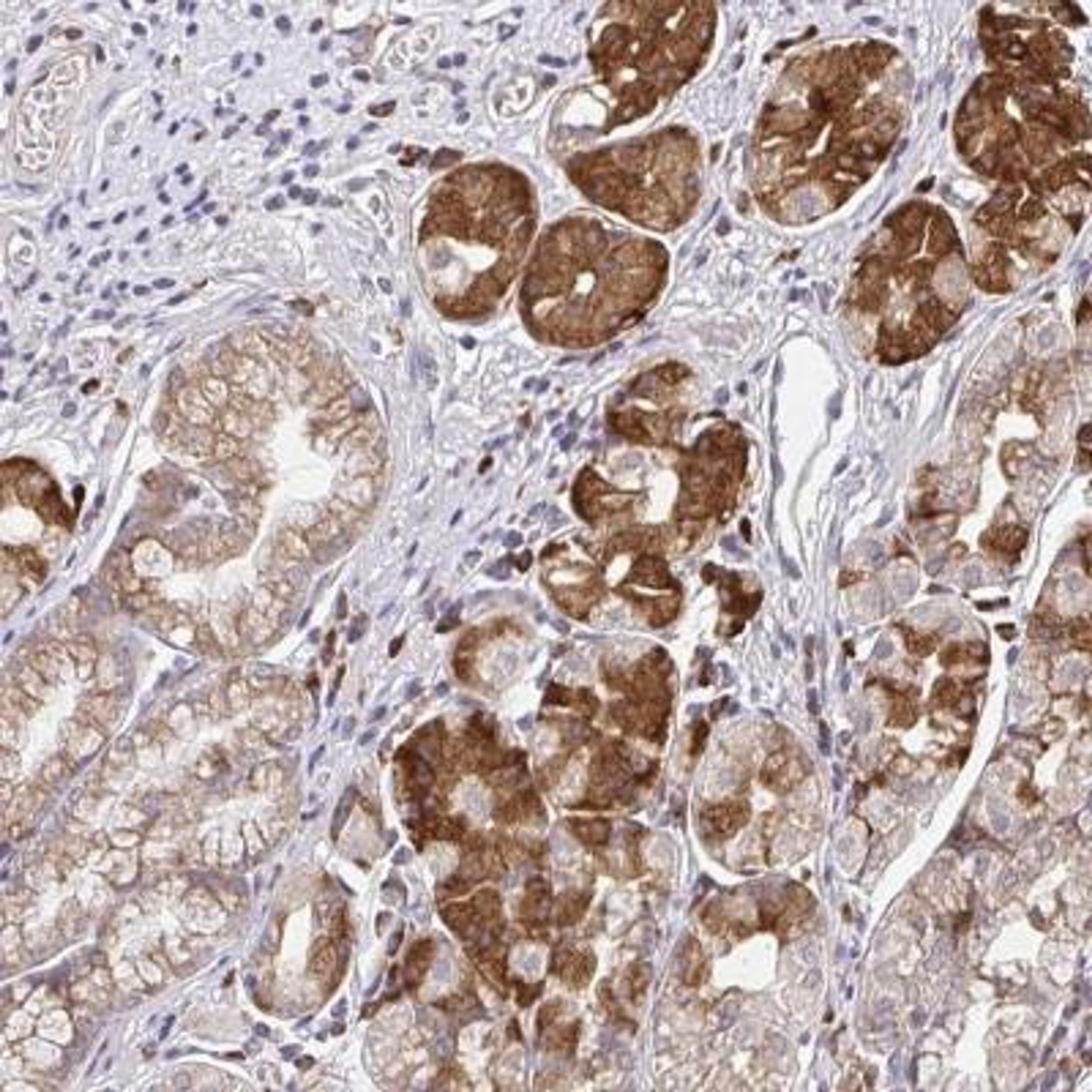 Immunohistochemistry: NAALADase-2/NAALAD2 Antibody [NBP2-31840] - Staining of human stomach, lower shows strong cytoplasmic positivity in glandular cells.