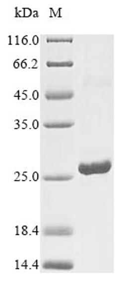 (Tris-Glycine gel) Discontinuous SDS-PAGE (reduced) with 5% enrichment gel and 15% separation gel.