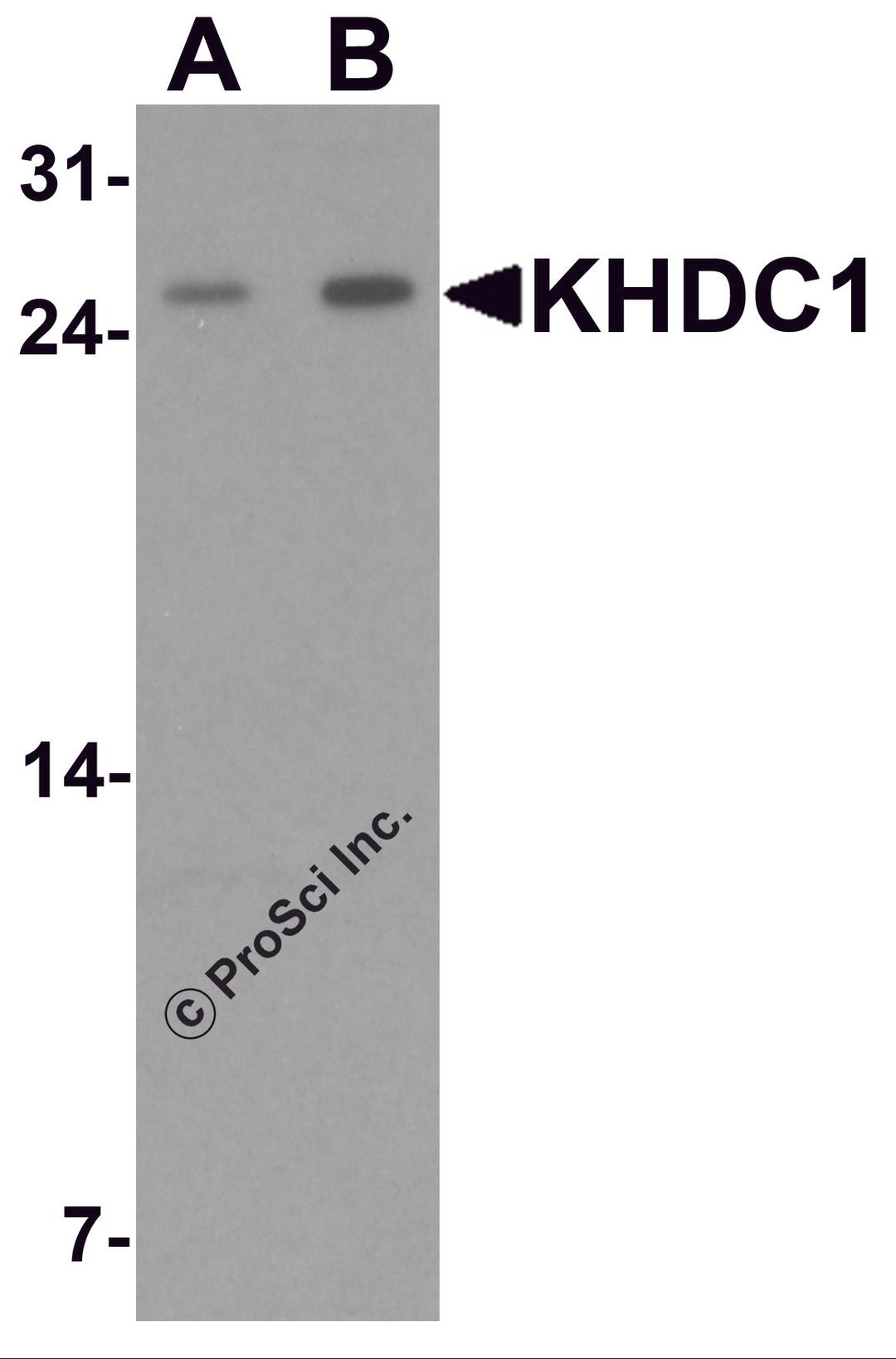 Western blot analysis of KHDC1 in rat liver tissue lysate with KHDC1 antibody at (A) 0.5 and (B) 1 μg/mL.
