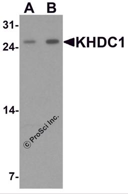Western blot analysis of KHDC1 in rat liver tissue lysate with KHDC1 antibody at (A) 0.5 and (B) 1 μg/mL.