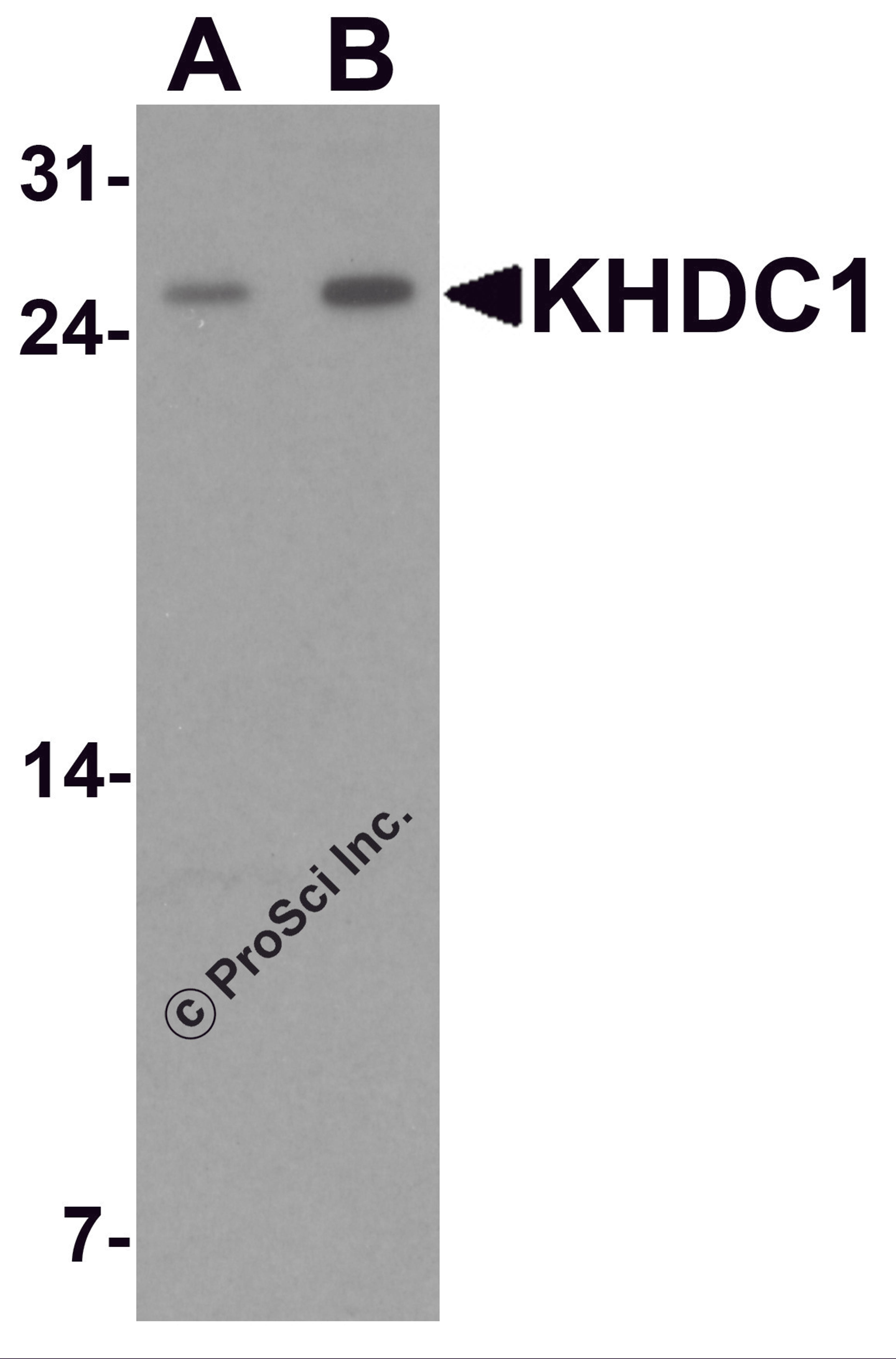 Western blot analysis of KHDC1 in rat liver tissue lysate with KHDC1 antibody at (A) 0.5 and (B) 1 μg/mL.